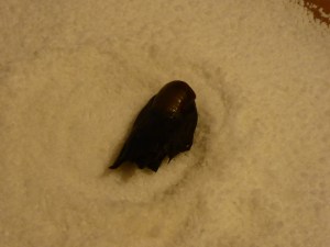 laut Internet einer von vielen Zehen? Angeblich gibt es Leute, die die "spenden" nach Op's o.ä.